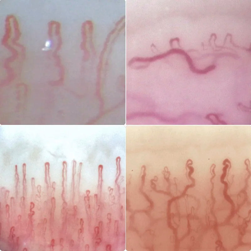 Instrumento de microcirculación capilar para pliegue ungueal digital en color 400X HD 