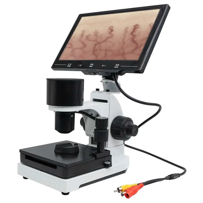 400X HD Color Digital Nailfold Capillary Microcirculation Microscope