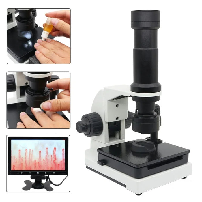 400X HD Color Digital Nailfold Capillary Microcirculation Microscope