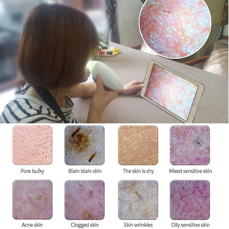 Detector elegante del cuero cabelludo/de la piel del cabello del microscopio inalámbrico de Digitaces WIFI de 3MP 