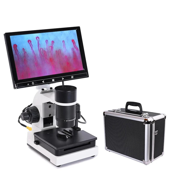 Microcirculation Inspection Microscope – Monocular Capillary Microscope with USB and 7" or 9" LCD Display